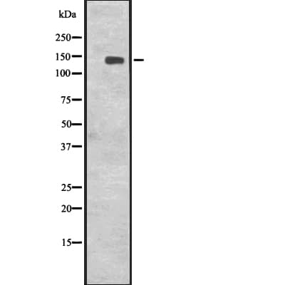 CENPJ / LAP Antibody