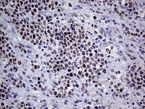 Monoclonal Mouse anti-Human MLH1 Antibody (clone OTI3C1, Carrier-free, aa299-527, IHC, WB)