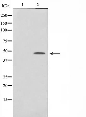 CTBP1 / CTBP Antibody (phospho-Ser422)