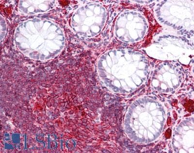 IHC-plus™ HLA-DRB1 Antibody (clone LN3)