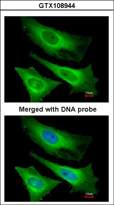 TNNI3K / CARK Antibody (aa187-403)