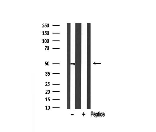 TNFRSF10A / DR4 Antibody