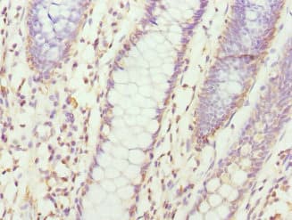 Polyclonal Rabbit anti-Human CXXC4 Antibody (IHC)