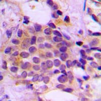 Polyclonal Rabbit anti-Human GCLM Antibody (Internal, IHC, WB)