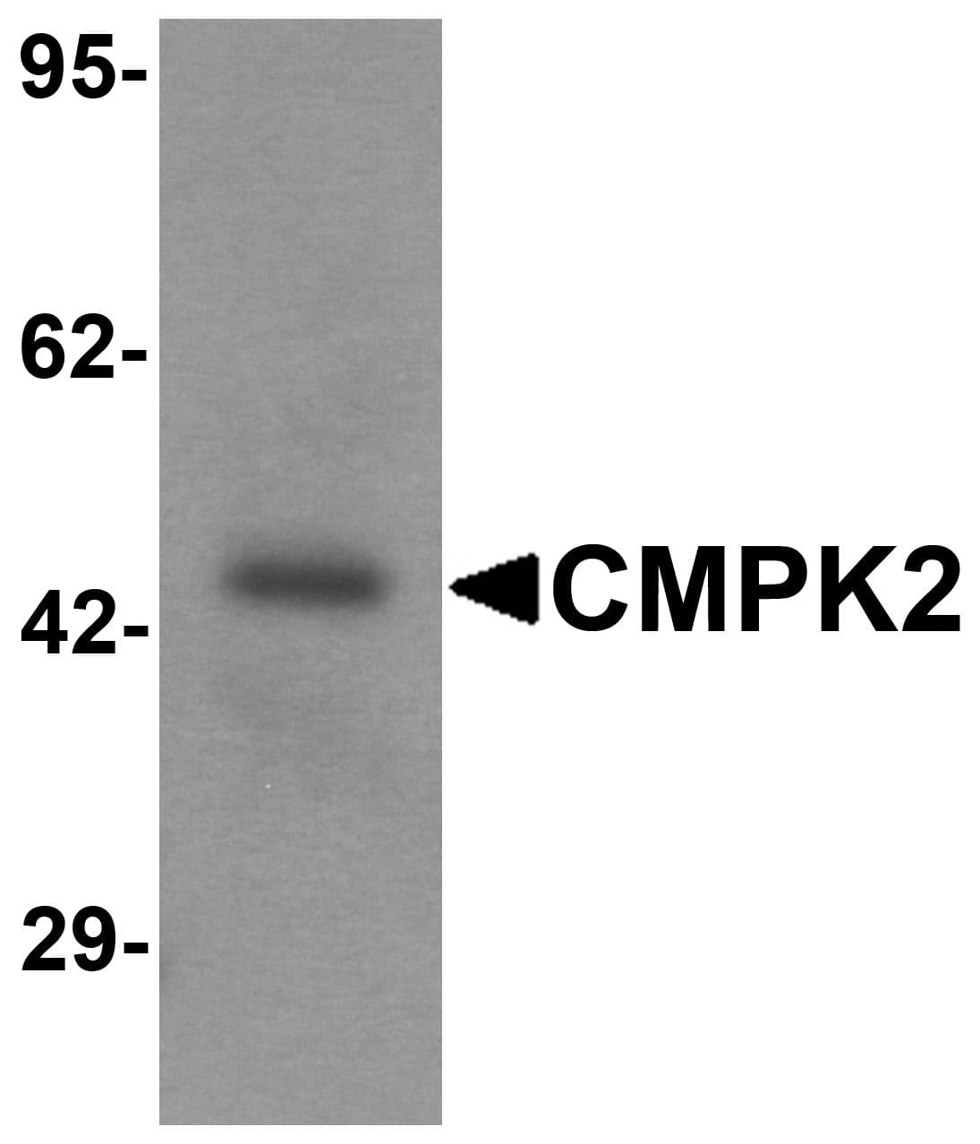 IHC-plus™ CMPK2 Antibody