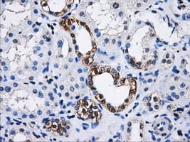 PME-1 / PPME1 Antibody (clone OTI7F12)
