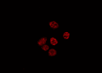 Polyclonal Rabbit anti-Human Histone H4 Antibody (Acetyl-Lys5, IHC, IF, WB)