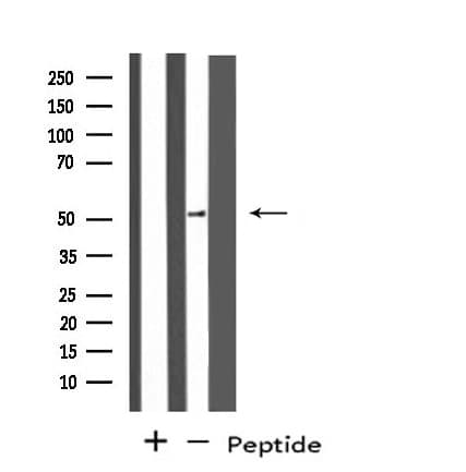 PPP4R1L Antibody