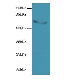 BLOM7 / KIAA0907 Antibody