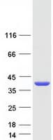 Human ANKRD45 Protein (Recombinant Myc-DDK (Flag))