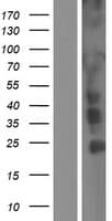 CCDC6 Protein (Over-Expression Lysate Myc-DDK (Flag))