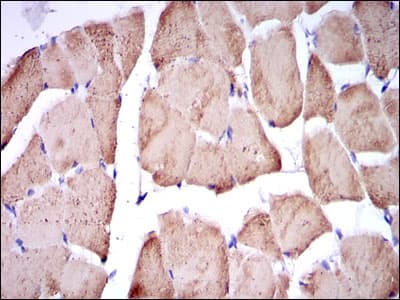 Monoclonal Mouse anti-Human TNNI2 Antibody (clone 2F12A11, IHC, WB)
