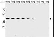 Monoclonal Mouse anti-Vaccinia Virus Vaccinia Virus H1L Antibody (clone 20CT26.44.10.3 / 20CT26.44.10.14, WB)
