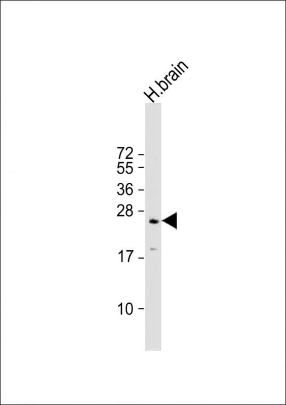 IHC-plus™ RAB3A Antibody (clone 1531CT562.14.57)