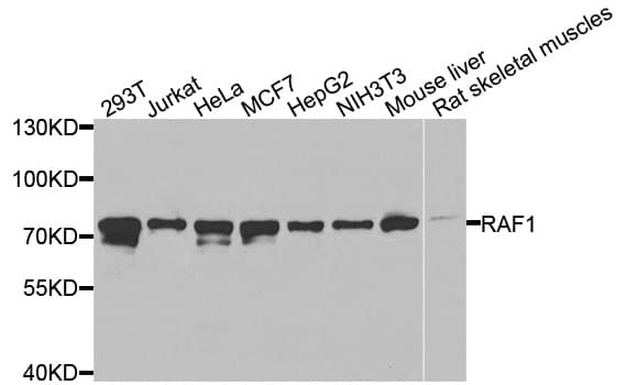 Polyclonal Rabbit anti-Human RAF1 / RAF Antibody (IHC, IF, WB)
