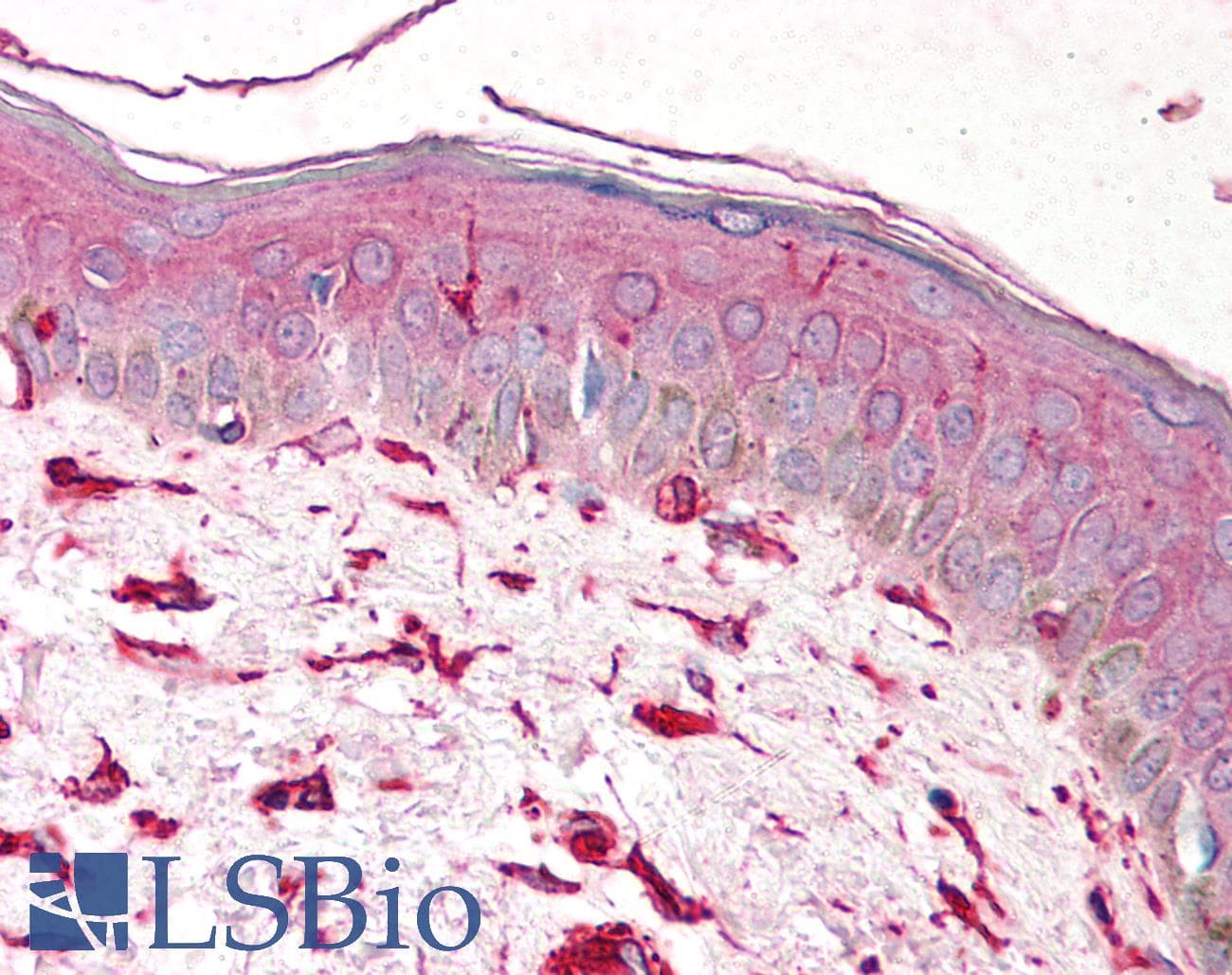 IHC-plus™ Monoclonal Mouse anti-Human Vimentin Antibody (clone VI-10, IHC, WB)