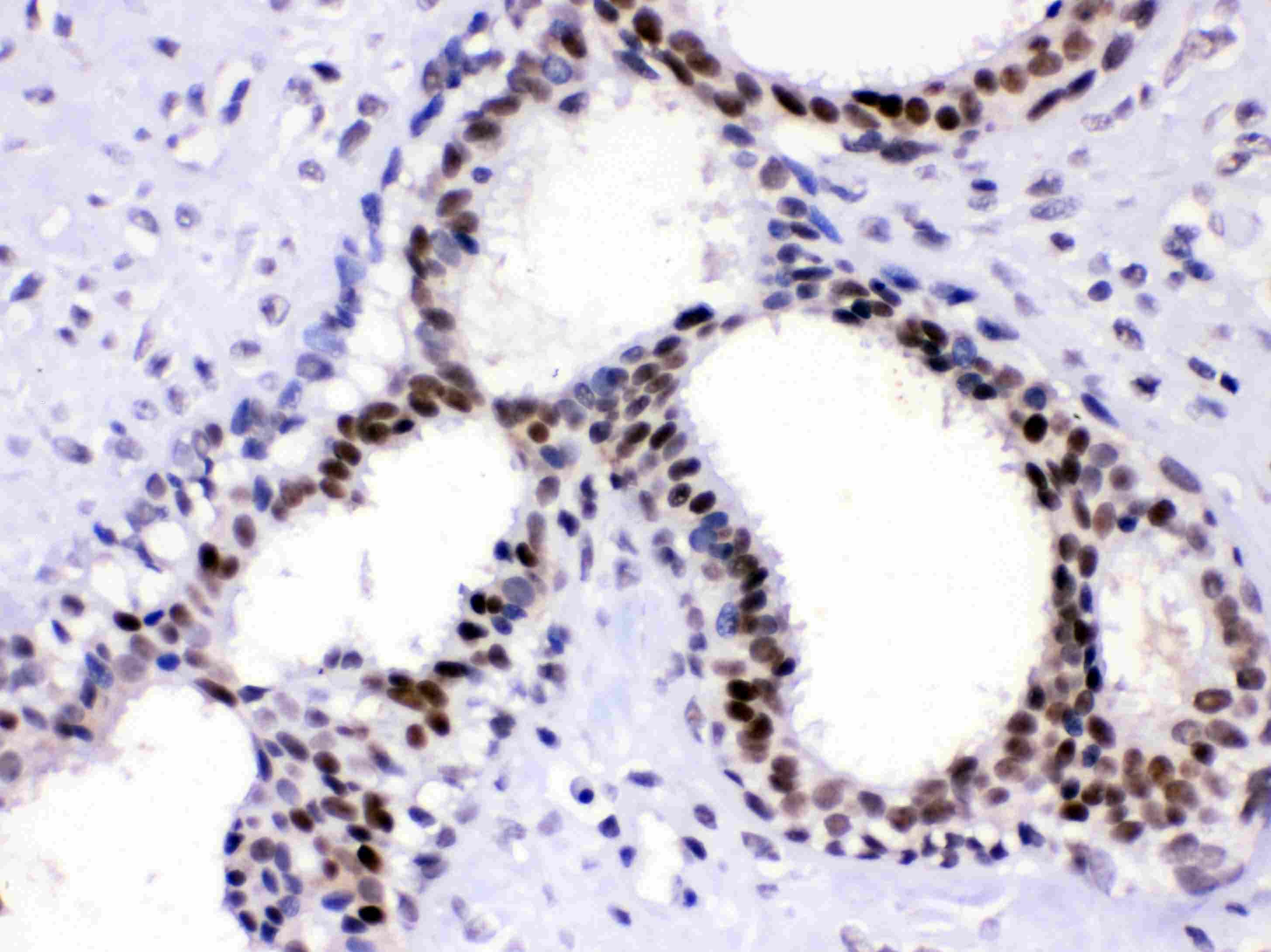 Polyclonal Rabbit anti-Human SUB1 Antibody (IHC, WB)