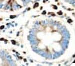 Sialylated Lewis a / CA 19-9 Antibody (clone 121SLE, Ready-to-Use)