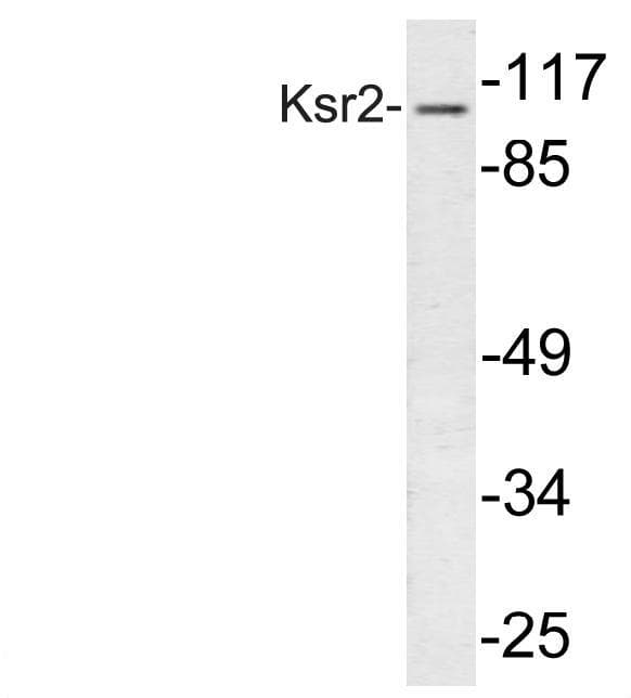 IHC-plus™ KSR2 Antibody (Ile694)