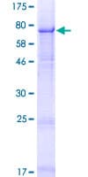 Human CRISPLD1 Protein (Recombinant GST)
