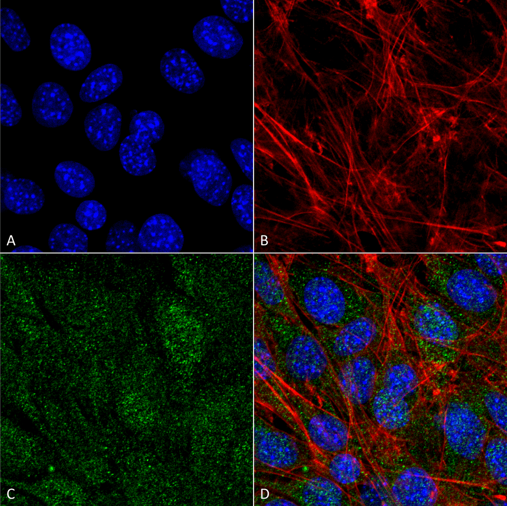 PIK3C3 / VPS34 Antibody (APC)