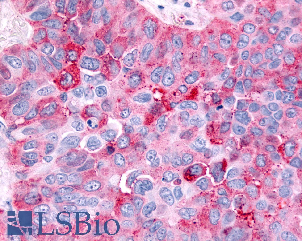 PathPlus™ HRH4 / Histamine H4 Receptor Antibody (Cytoplasmic Domain)