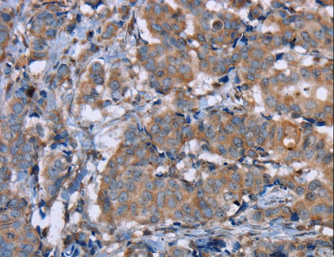 PON1 / ESA Antibody