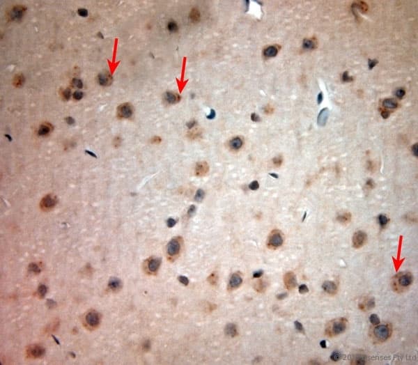 CACNA2D1 Antibody (aa600-650)