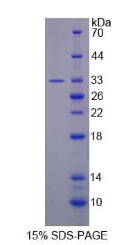 Rat PER2 Protein (Recombinant His-S)