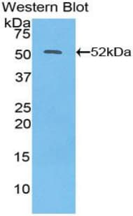 IFN Beta / Interferon Beta Antibody (aa22-187)