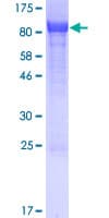 Human SOLO / SESTD1 Protein (Recombinant GST)