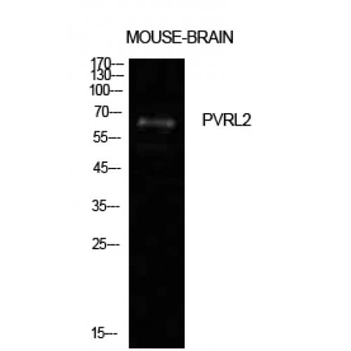 PVRL2 / CD112 Antibody (151-200 aa, Internal)