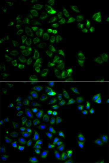 HTRA2 / OMI Antibody