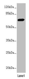 Polyclonal Rabbit anti-Human PPP2R3B Antibody (IHC, WB)