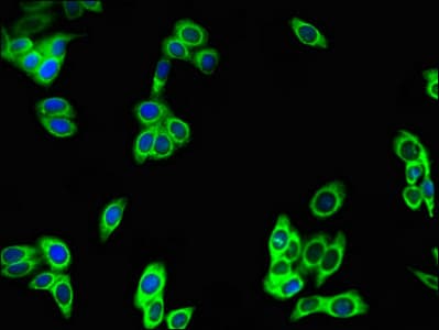 Polyclonal Rabbit anti-Human DEPDC2 Antibody (IHC, IF, WB)