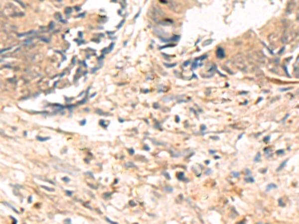 Polyclonal Rabbit anti-Human ABHD2 Antibody (IHC)