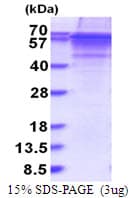 Human VTN / Vitronectin Protein (Recombinant His)