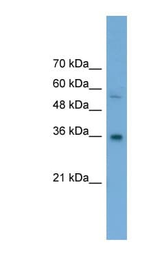GALE / UDP-Glucose 4-Epimerase Antibody (aa201-250)