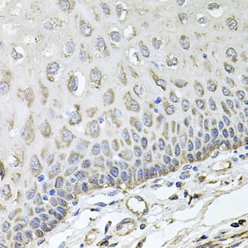Polyclonal Rabbit anti-Human RHOT1 Antibody (IHC, WB)