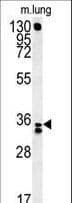 Polyclonal Rabbit anti-Human RCN3 Antibody (aa134-163, WB)