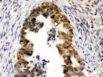 UHRF1 Antibody