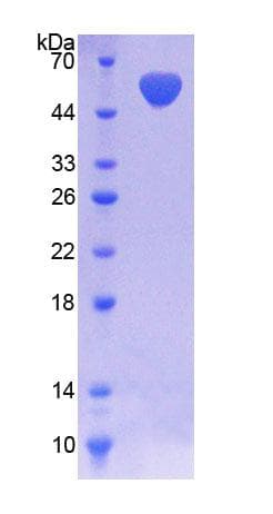 Human NADK / NAD Kinase Protein (Recombinant His-GST)