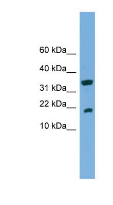 ACP1 / Acid Phosphatase Antibody (aa35-84)