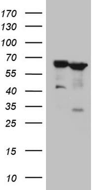 PROZ / Protein Z Antibody (aa115-400, clone OTI3E5)