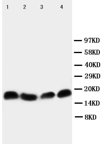 Polyclonal Rabbit anti-Human BIRC5 / Survivin Antibody (aa121-142, WB)