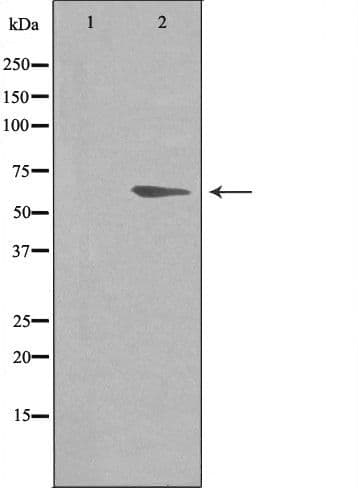 ADRB2 Antibody