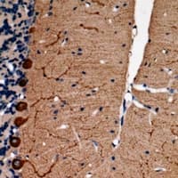 SYT12 / Synaptotagmin XII Antibody