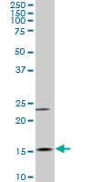 MYL6 Antibody (clone 1D6)