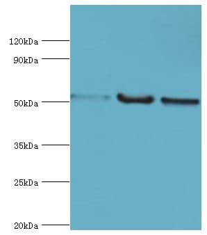Polyclonal Rabbit anti-Human G3BP1 / G3BP Antibody (aa227-466, IHC, WB)
