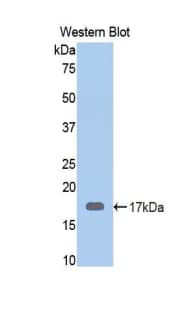 CALR / Calreticulin Antibody (aa196-310, APC)